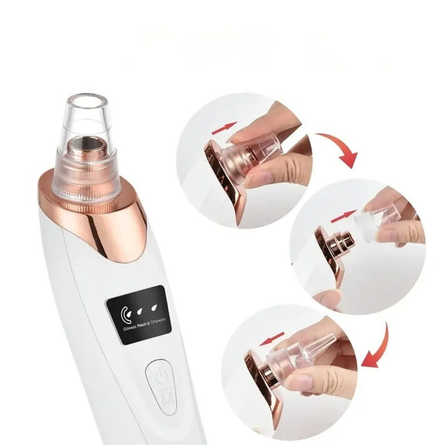 Rechargeable Pore Vacuum – 6-in-1 Blackhead Remover with Smart Display & Extraction Kit