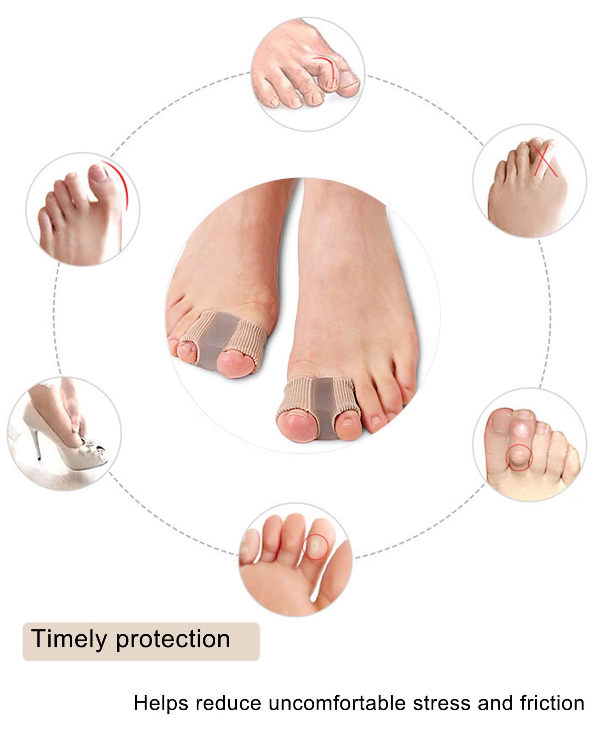 Woyuosn Premium Elastic Toe Separators – Comfortable Pain Relief & Alignment