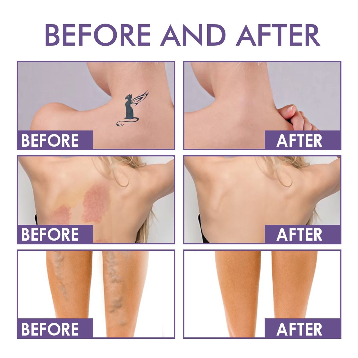 ✨ Body Coverage Perfector – Waterproof, lightweight & flawless body makeup