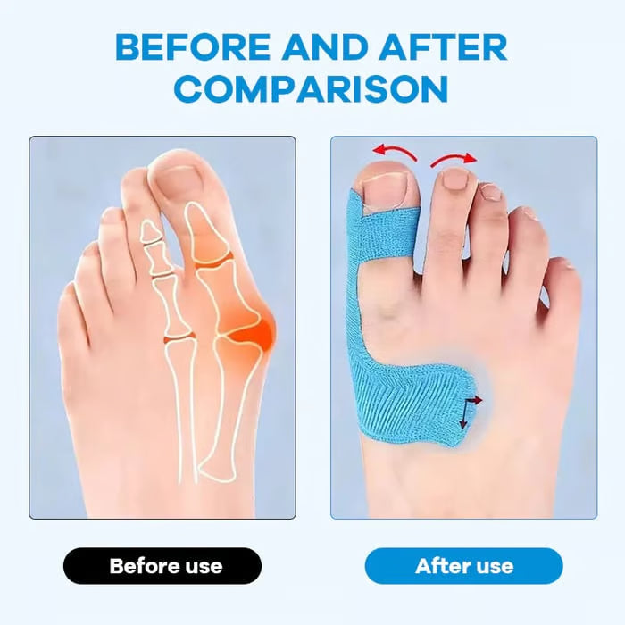👣Pre-cut Therapeutic Tape